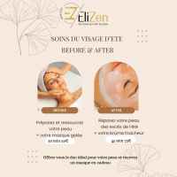 soin du visage d'été before et after by Elizen